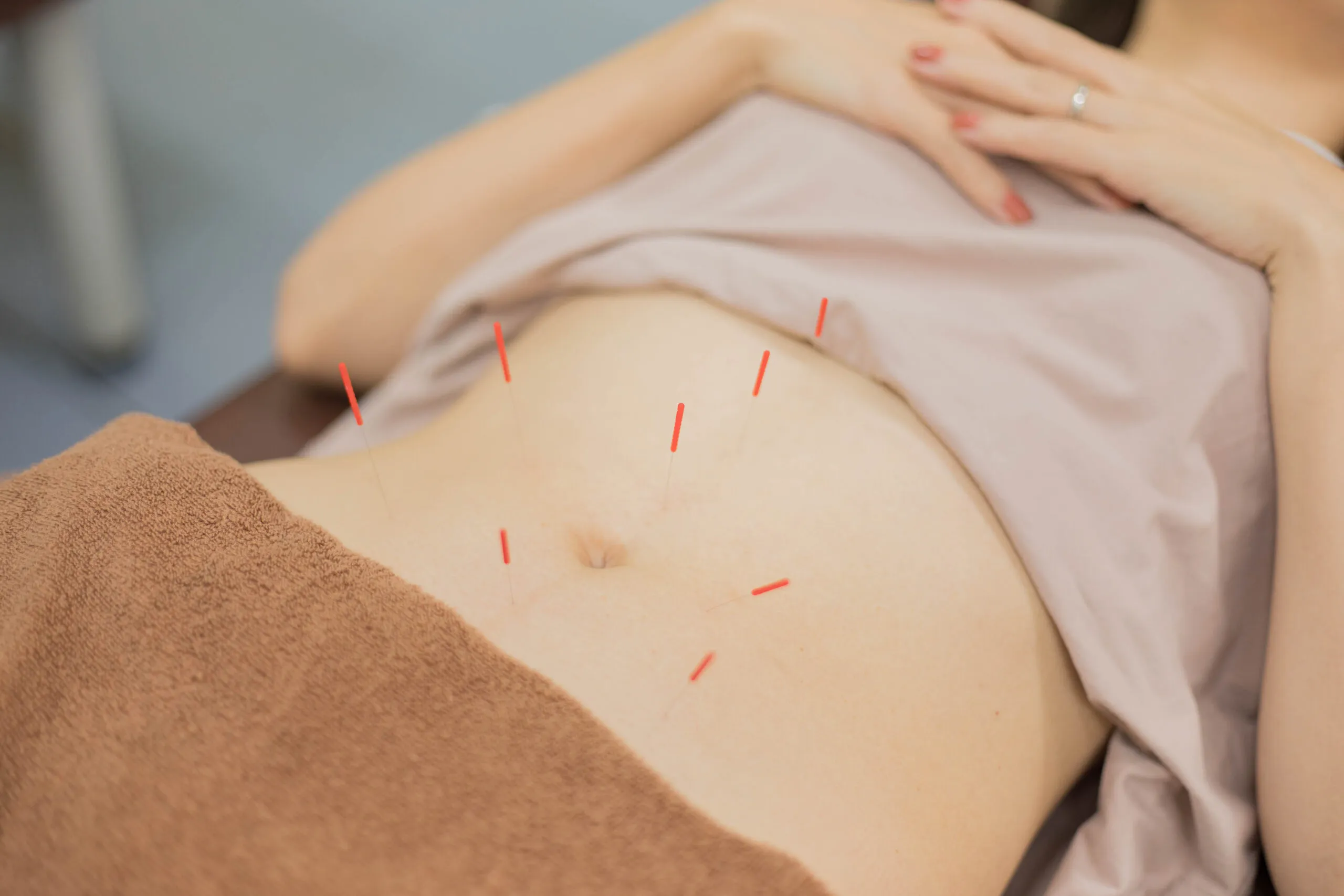 阿佐ヶ谷中央整骨院の経穴へのアプローチ施術の様子